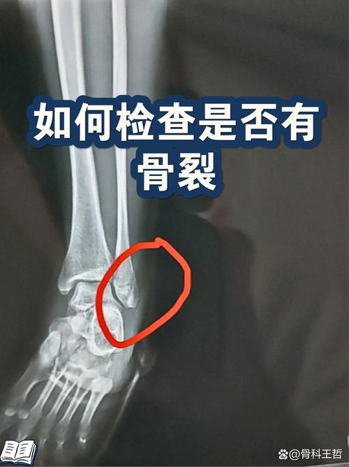 官方：杰登麦克丹尼尔斯遭左膝髌腱炎&骨头挫伤被列入每周观察